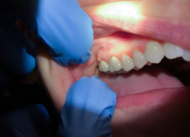 Best Mobile Emergency Dentist in St Paris, OH