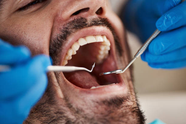 Best Emergency Dental Care for Abscessed Tooth in St Paris, OH